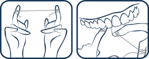 How to use spongy interdental thread with microRepair®