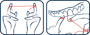 Modo d'uso filo cerato scorrevole con microRepair®