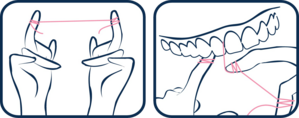 Modo d'uso filo interdentale ESPANDIBILE con microRepair®